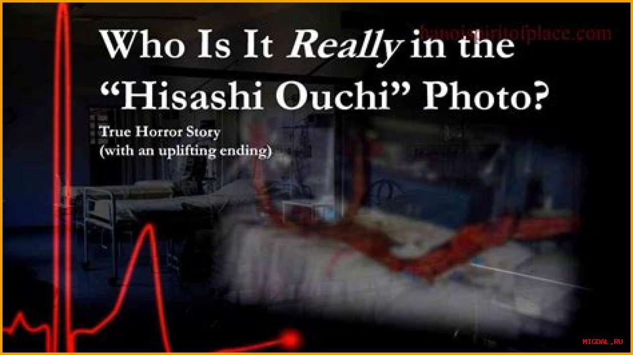 Hisashi Ouchi: The Tragic Story Behind The Real Picture